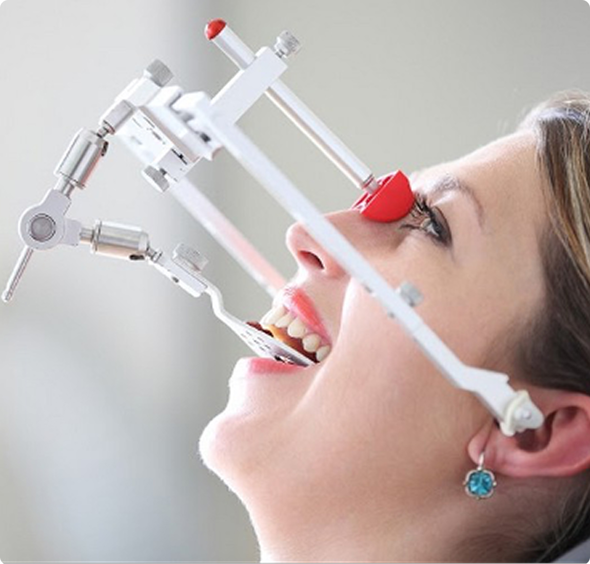 Лечение кисты зуба