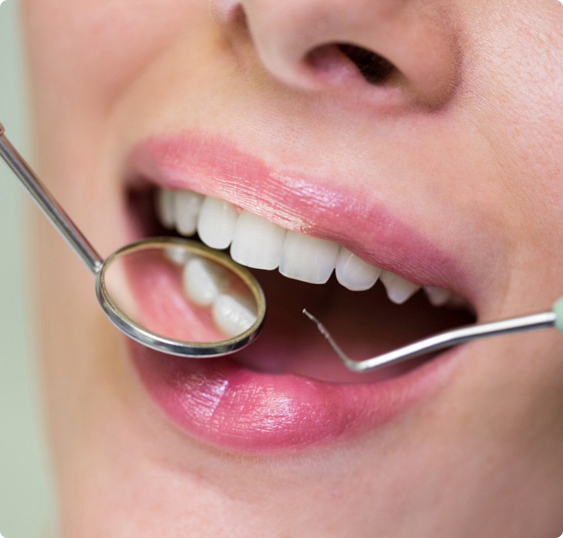 Пластика дёсен